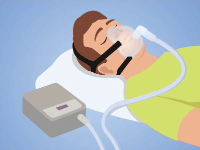 CPAP-masker als alternatief voor anti snurk band bij slaapapneu